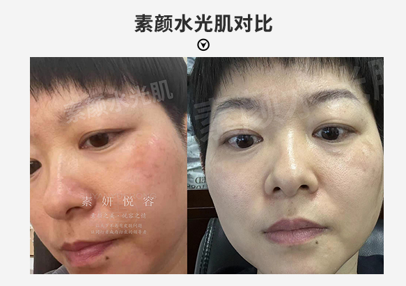 Dull skin before after