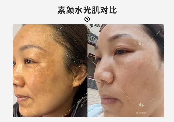 Spot before after
