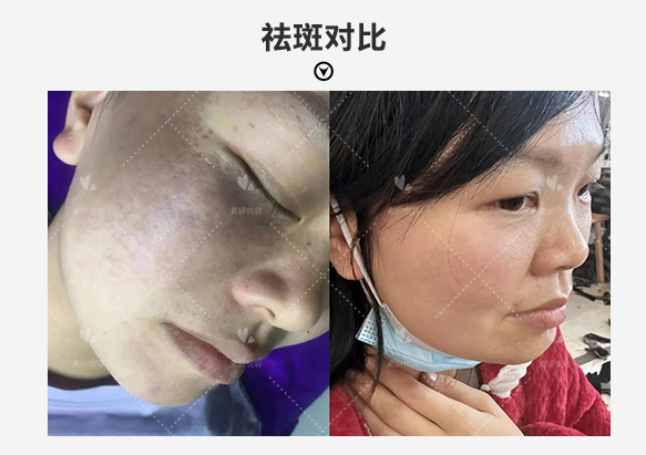 Spot removal before after