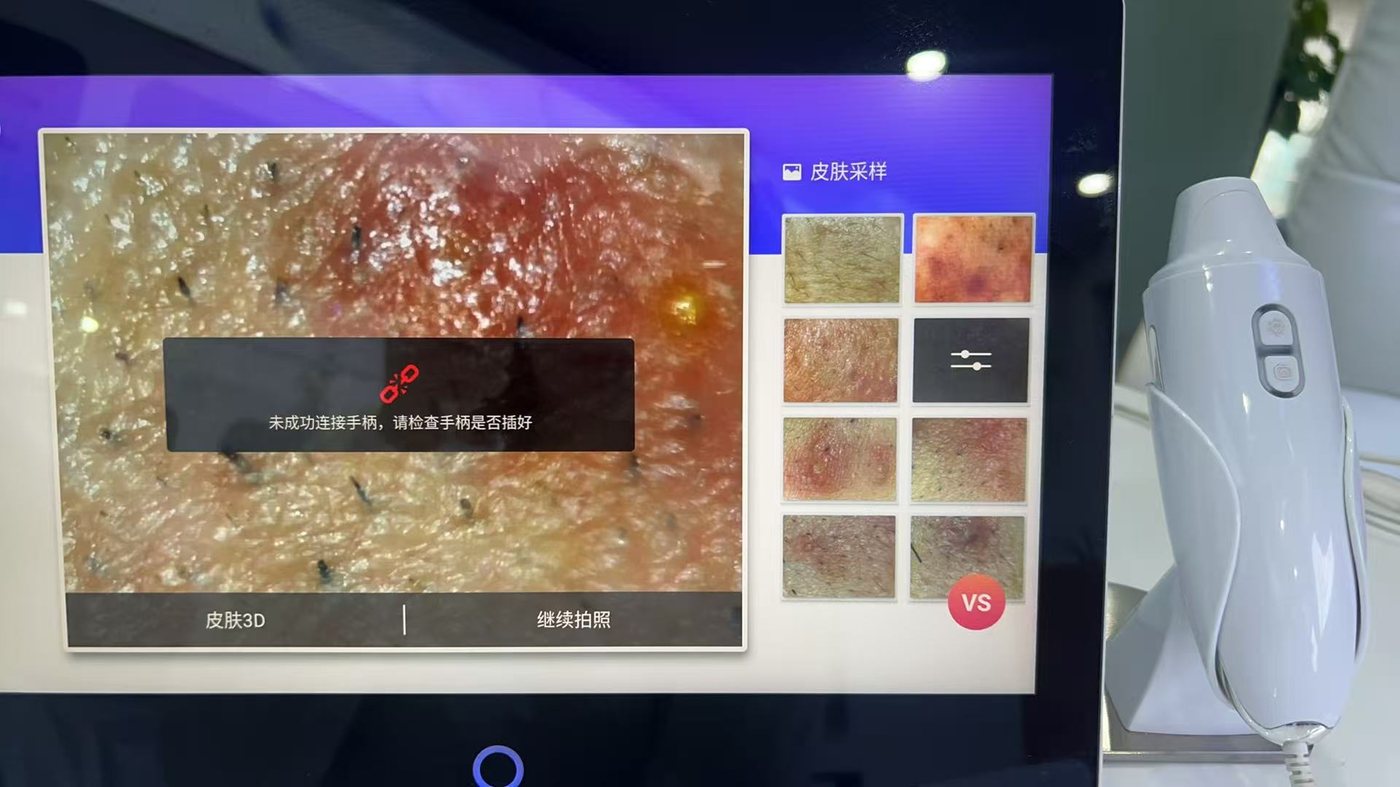 AI skin analyzer in use - skin sampling screen